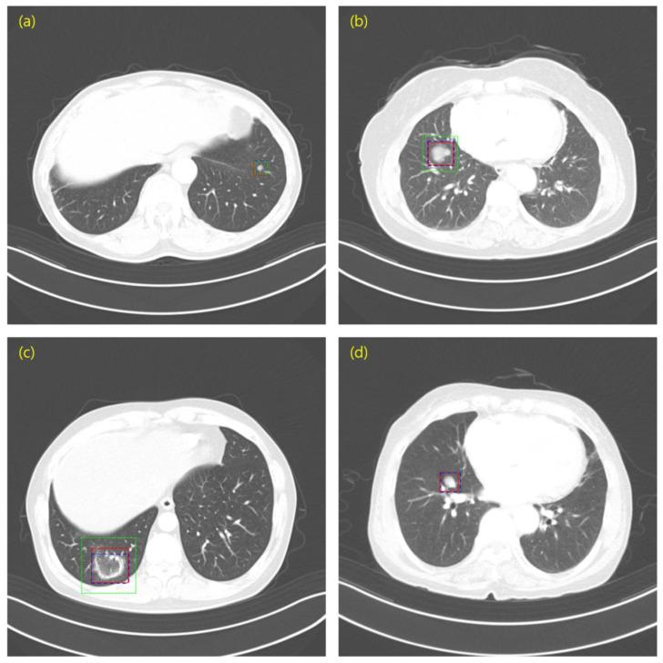 https://cdn.ncbi.nlm.nih.gov/pmc/blobs/22ed/9265117/9e265064db84/cancers-14-03174-g006.jpg