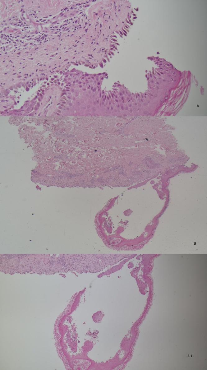 https://cdn.ncbi.nlm.nih.gov/pmc/blobs/22ef/12255323/4f9a1d59cb1f/IMCRJ-18-851-g0004.jpg