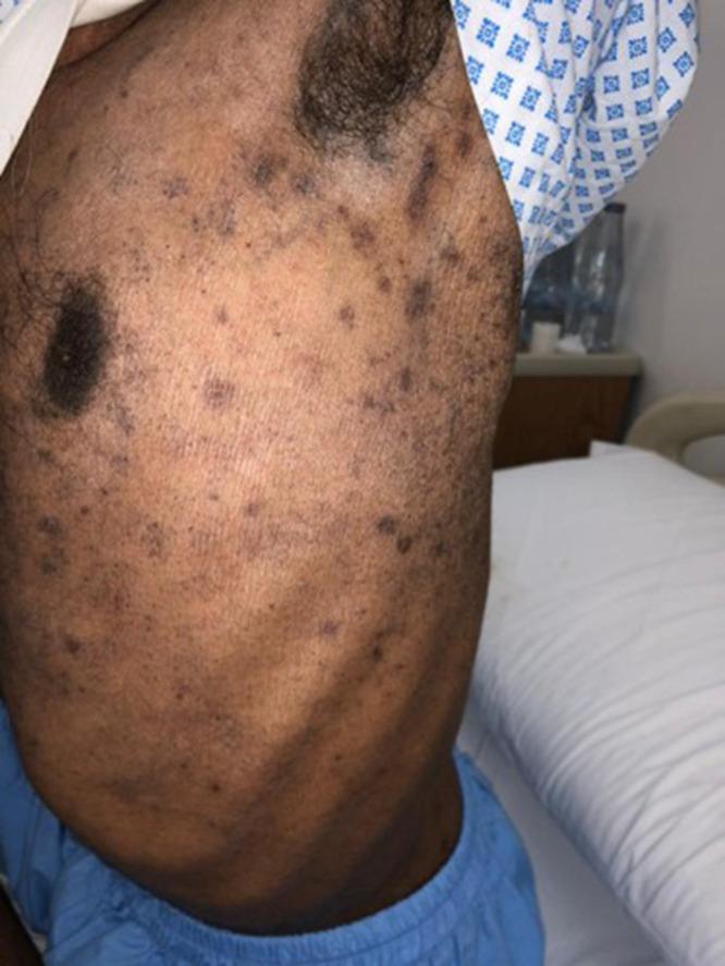 https://cdn.ncbi.nlm.nih.gov/pmc/blobs/22ef/12255323/8adaa8acd025/IMCRJ-18-851-g0002.jpg