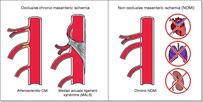 https://cdn.ncbi.nlm.nih.gov/pmc/blobs/22f4/7226699/915694397e55/10.1177_2050640620916681-fig2.jpg