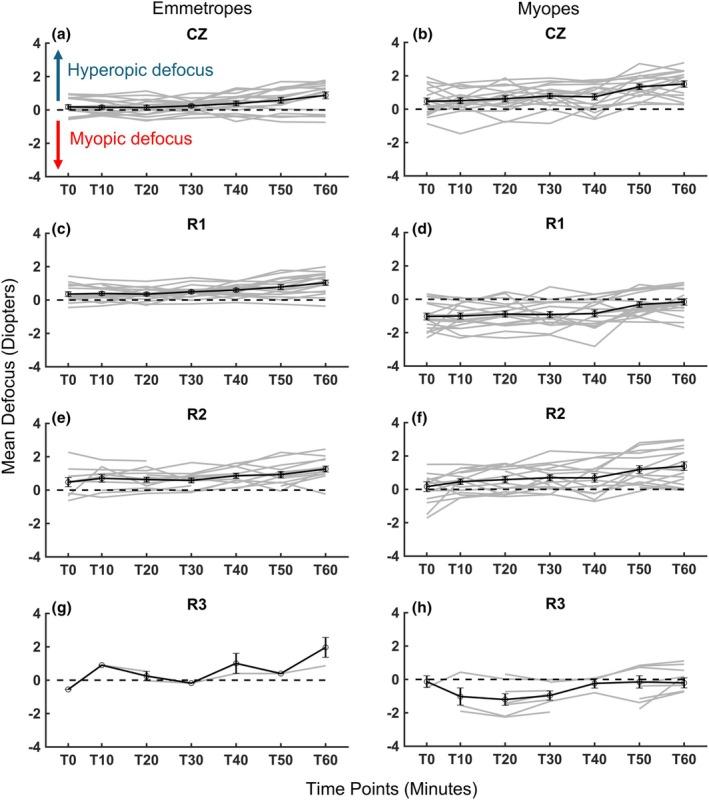 https://cdn.ncbi.nlm.nih.gov/pmc/blobs/22f8/12357234/512b99d05cef/OPO-45-1456-g006.jpg