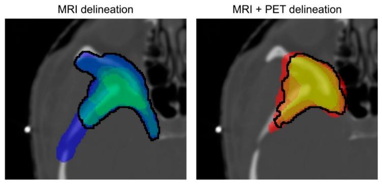 https://cdn.ncbi.nlm.nih.gov/pmc/blobs/230e/9497299/b0daaad18ffb/cancers-14-04435-g001.jpg