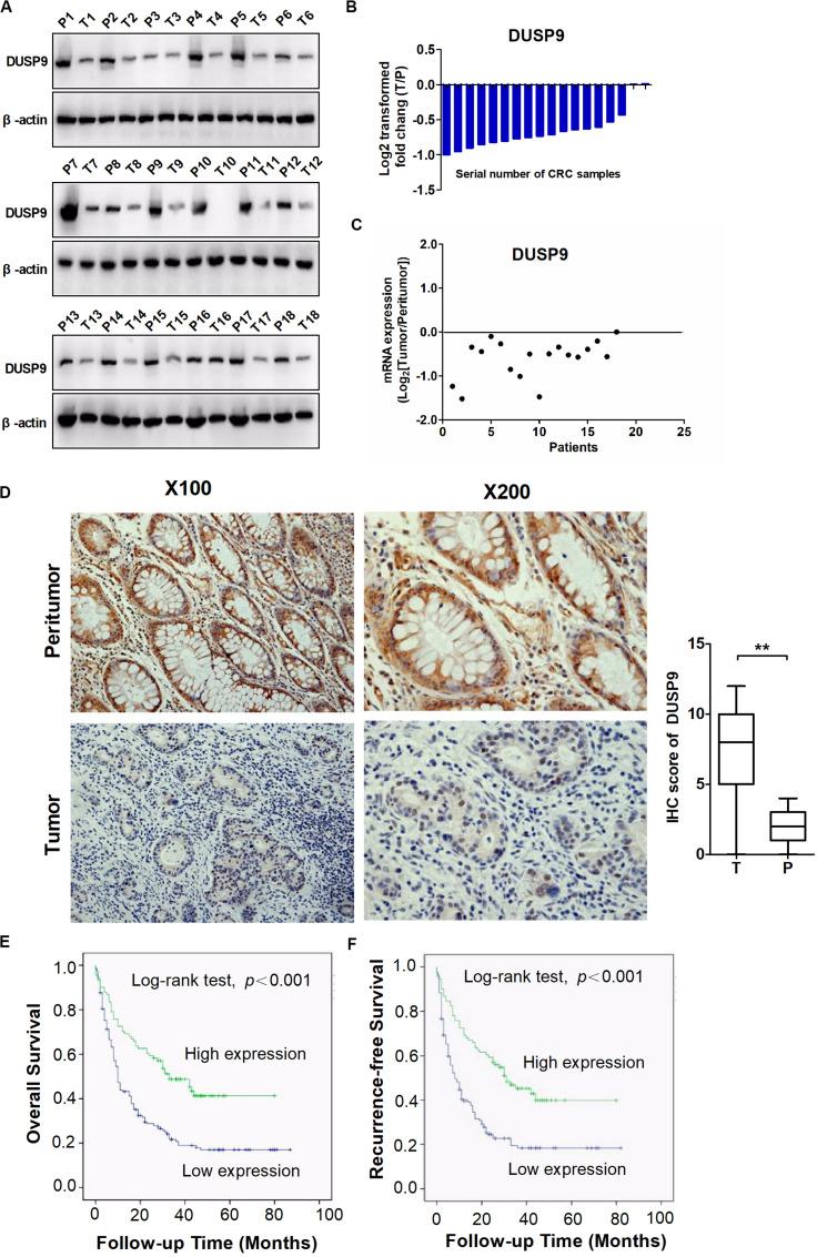 https://cdn.ncbi.nlm.nih.gov/pmc/blobs/2311/7538709/97440a4e66e4/fonc-10-547011-g001.jpg