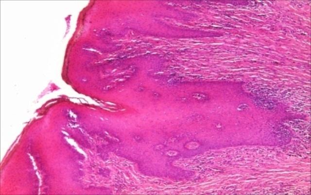 https://cdn.ncbi.nlm.nih.gov/pmc/blobs/231a/6286465/6c249d6b9288/CHSJ-43-04-13.FIG3.jpg
