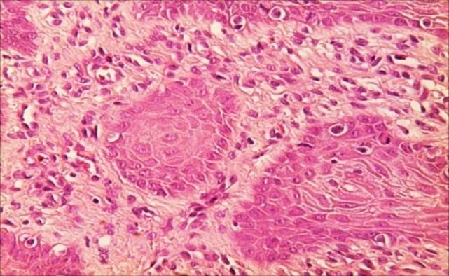 https://cdn.ncbi.nlm.nih.gov/pmc/blobs/231a/6286465/87e6d68e8781/CHSJ-43-04-13.FIG4.jpg