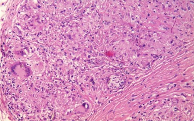 https://cdn.ncbi.nlm.nih.gov/pmc/blobs/231a/6286465/9be010921a65/CHSJ-43-04-13.FIG10.jpg