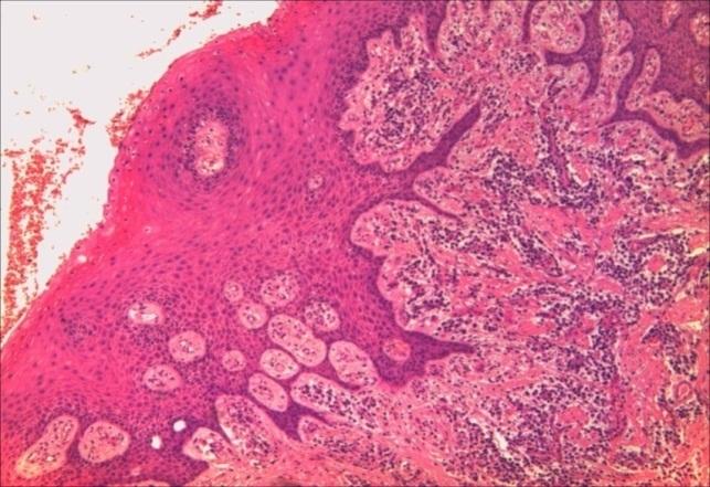 https://cdn.ncbi.nlm.nih.gov/pmc/blobs/231a/6286465/ae0683bf7507/CHSJ-43-04-13.FIG2.jpg
