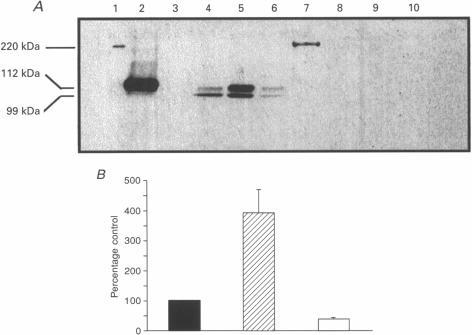 https://cdn.ncbi.nlm.nih.gov/pmc/blobs/231c/1159909/48bd7a4dadd3/jphysiol00378-0037-a.jpg