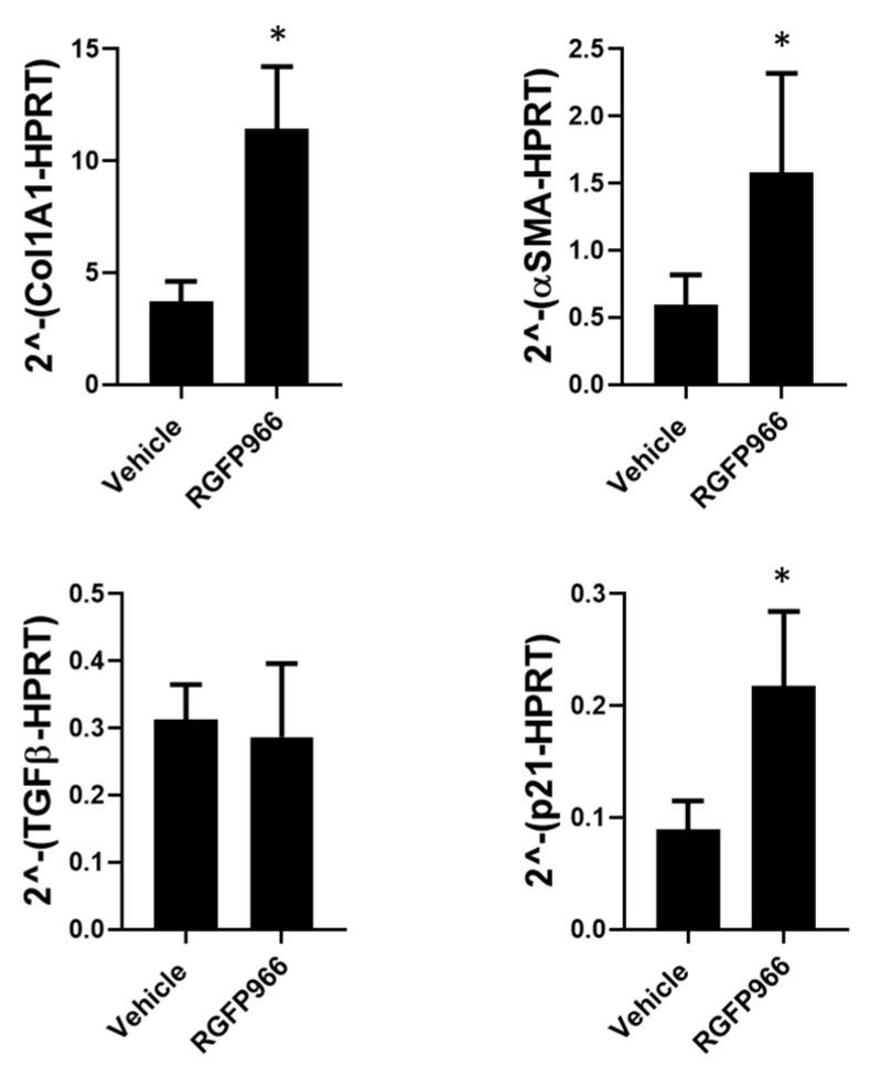 https://cdn.ncbi.nlm.nih.gov/pmc/blobs/2320/10093275/28e1bf6c2151/cells-12-01020-g004.jpg