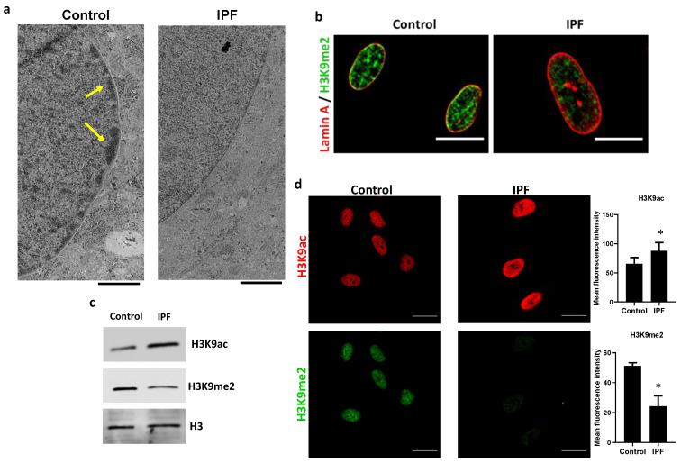 https://cdn.ncbi.nlm.nih.gov/pmc/blobs/2320/10093275/cebfb28ff186/cells-12-01020-g002.jpg
