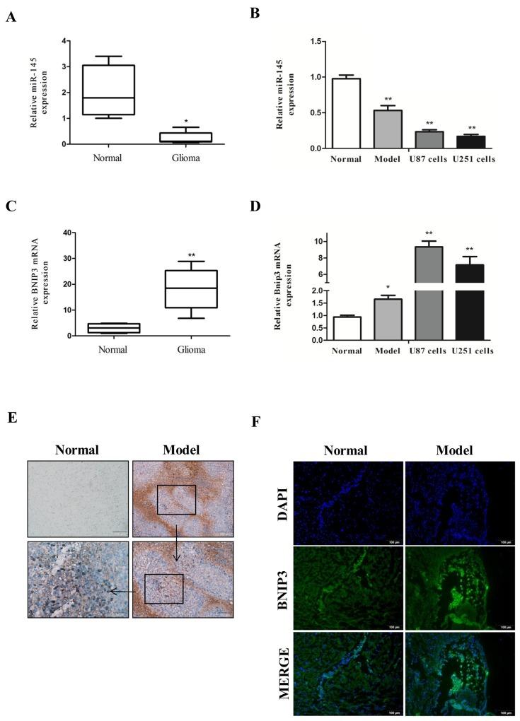 https://cdn.ncbi.nlm.nih.gov/pmc/blobs/2323/5617441/59dbd266c70b/oncotarget-08-61510-g002.jpg
