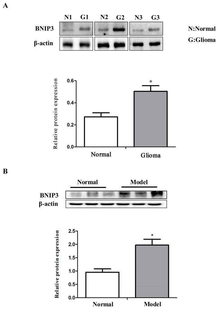 https://cdn.ncbi.nlm.nih.gov/pmc/blobs/2323/5617441/ce48c53780cd/oncotarget-08-61510-g003.jpg