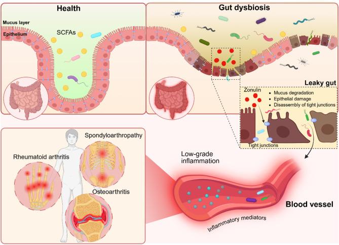 https://cdn.ncbi.nlm.nih.gov/pmc/blobs/2328/12090658/0d877707e089/13287_2025_4386_Fig3_HTML.jpg