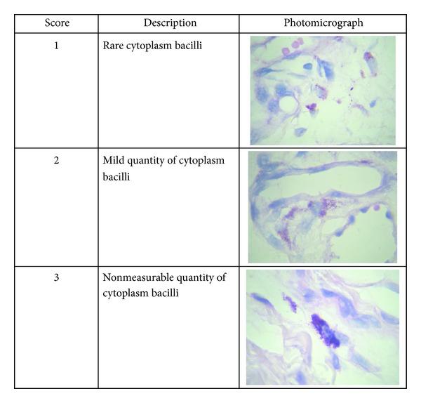 https://cdn.ncbi.nlm.nih.gov/pmc/blobs/232d/3569925/759b5f41bca9/ECAM2013-686018.002.jpg