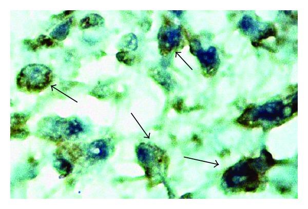 https://cdn.ncbi.nlm.nih.gov/pmc/blobs/232d/3569925/960e894f0193/ECAM2013-686018.008.jpg
