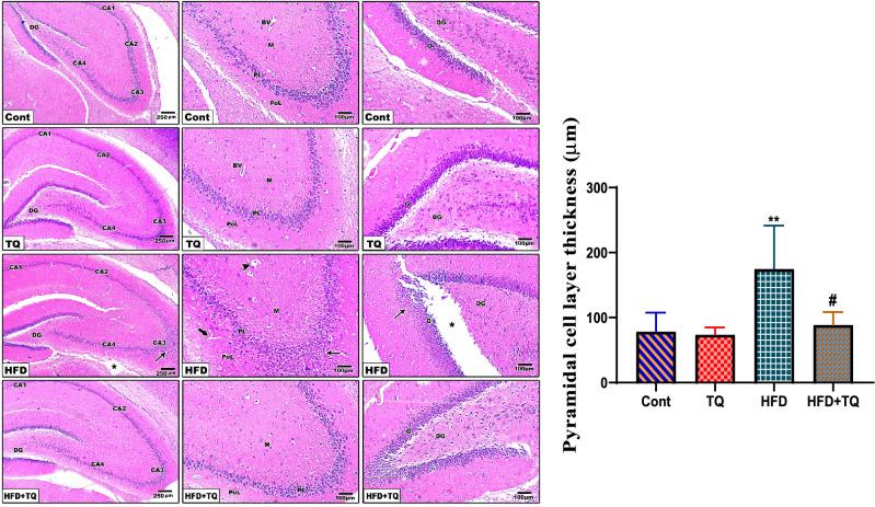 https://cdn.ncbi.nlm.nih.gov/pmc/blobs/2339/12181254/1ad63cf3e032/41598_2025_5716_Fig12_HTML.jpg