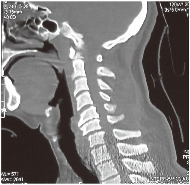 https://cdn.ncbi.nlm.nih.gov/pmc/blobs/233d/4149985/2dbdf9591ec4/asj-8-427-g003.jpg