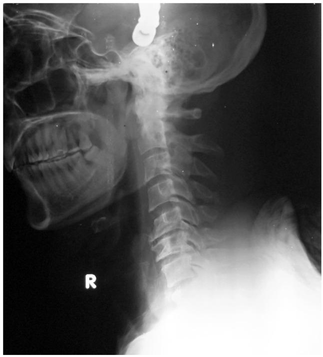 https://cdn.ncbi.nlm.nih.gov/pmc/blobs/233d/4149985/303024421cff/asj-8-427-g002.jpg