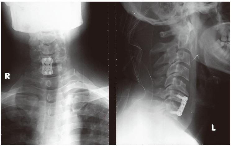 https://cdn.ncbi.nlm.nih.gov/pmc/blobs/233d/4149985/a884ae6fbbbc/asj-8-427-g005.jpg