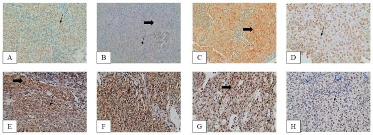 https://cdn.ncbi.nlm.nih.gov/pmc/blobs/233e/10377518/3c1012eeec92/biomedicines-11-01876-g001.jpg
