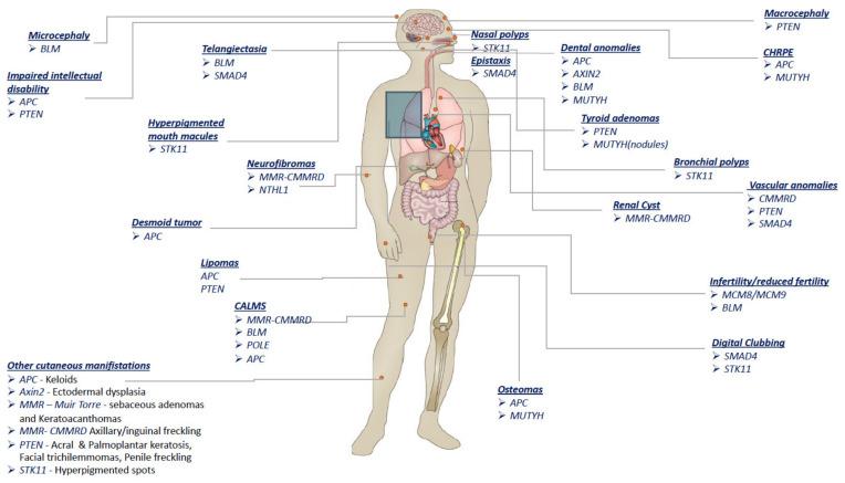 https://cdn.ncbi.nlm.nih.gov/pmc/blobs/233f/8833640/87a3bb09bfa0/cancers-14-00628-g001.jpg