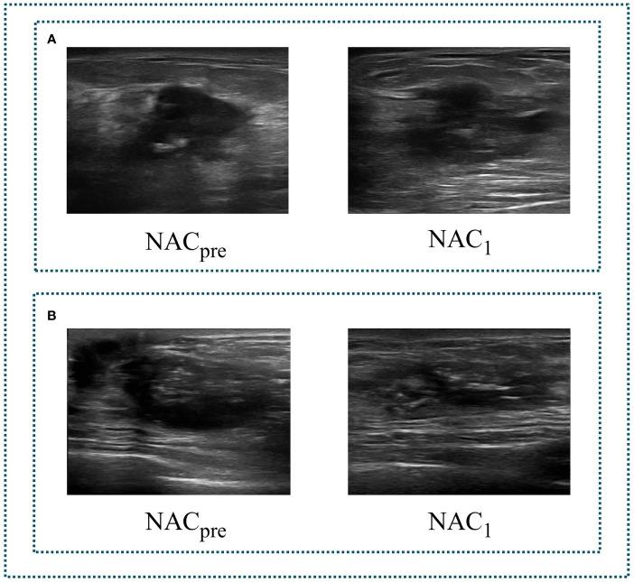 https://cdn.ncbi.nlm.nih.gov/pmc/blobs/2344/9026439/7b79803bbd64/fonc-12-812463-g002.jpg