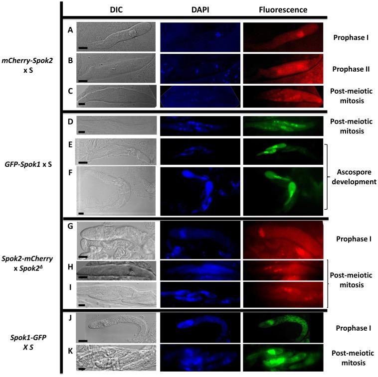 https://cdn.ncbi.nlm.nih.gov/pmc/blobs/2345/4022471/17401f1c8aa4/pgen.1004387.g005.jpg