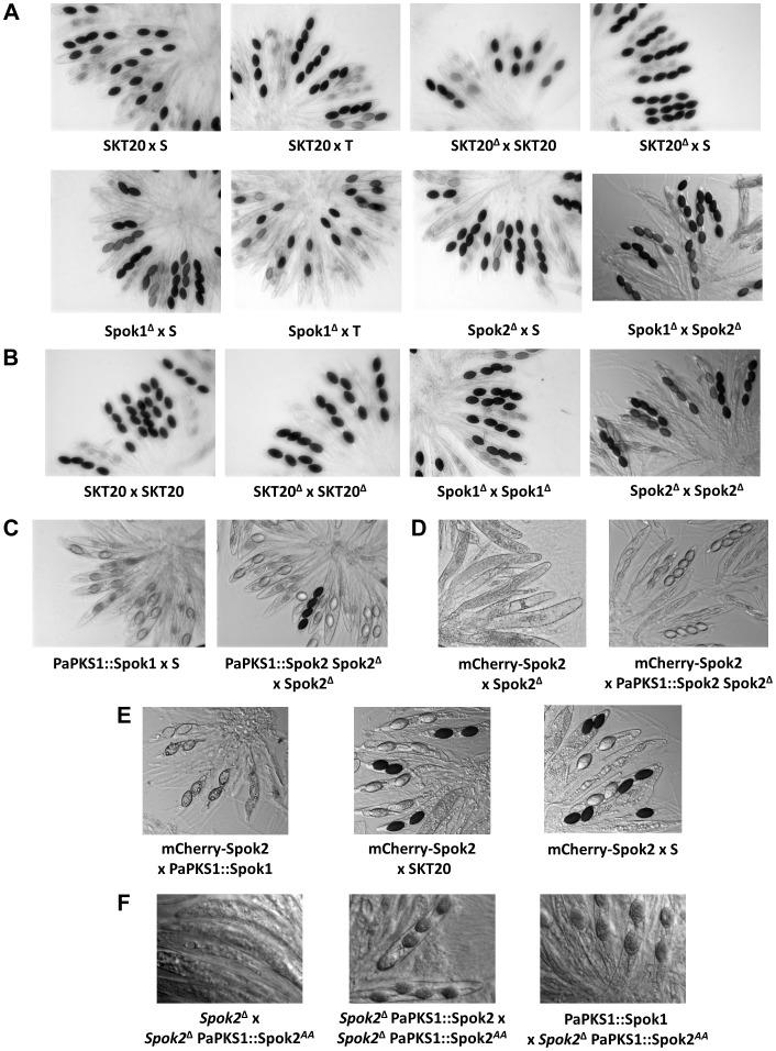 https://cdn.ncbi.nlm.nih.gov/pmc/blobs/2345/4022471/cfc914a68cb9/pgen.1004387.g003.jpg