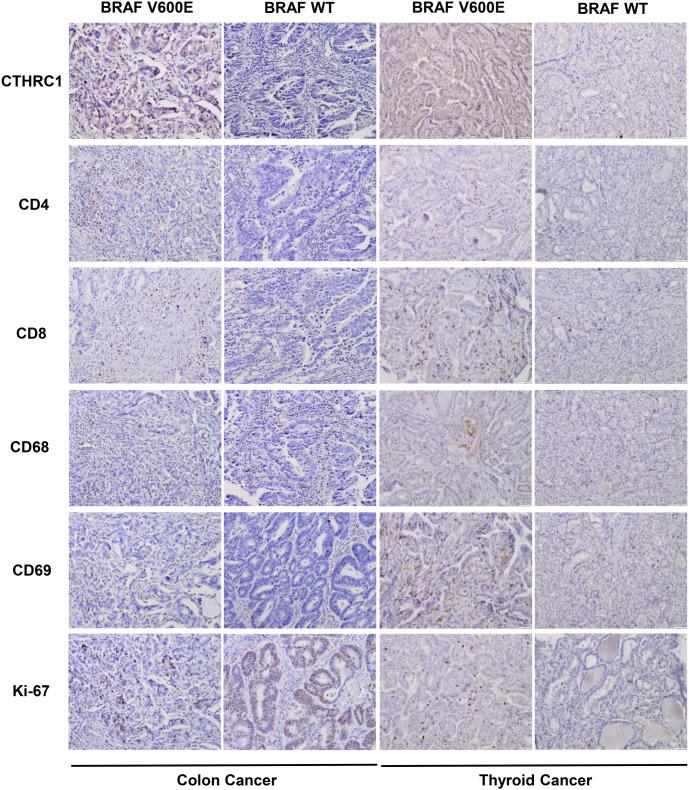 https://cdn.ncbi.nlm.nih.gov/pmc/blobs/2347/11647256/9e3f3ae67063/bb-2024-10397f6.jpg