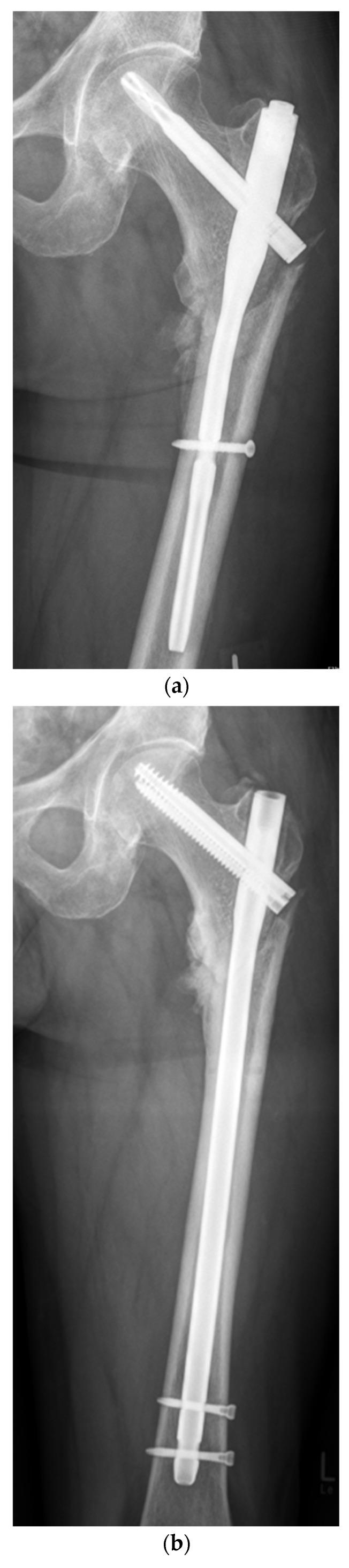 https://cdn.ncbi.nlm.nih.gov/pmc/blobs/2356/11205226/5c845d1c1b38/jcm-13-03591-g002a.jpg