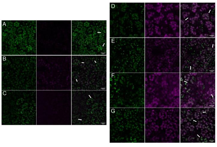 https://cdn.ncbi.nlm.nih.gov/pmc/blobs/2356/8657445/d08b7ad4d0ce/ijms-22-12666-g002.jpg