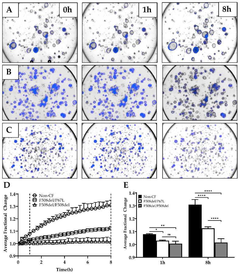https://cdn.ncbi.nlm.nih.gov/pmc/blobs/235a/7349680/a6624b8a22b1/genes-11-00603-g007.jpg