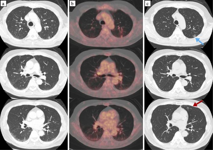 https://cdn.ncbi.nlm.nih.gov/pmc/blobs/235f/10937140/a10b2ef0a601/1349-7235-63-0559-g001.jpg