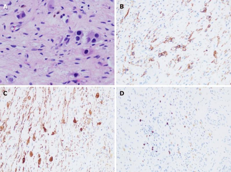 https://cdn.ncbi.nlm.nih.gov/pmc/blobs/2362/6656671/9441e1f907a6/WJCC-7-1499-g004.jpg