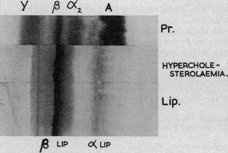https://cdn.ncbi.nlm.nih.gov/pmc/blobs/2366/1889264/94ccbec040be/procrsmed00376-0139-a.jpg