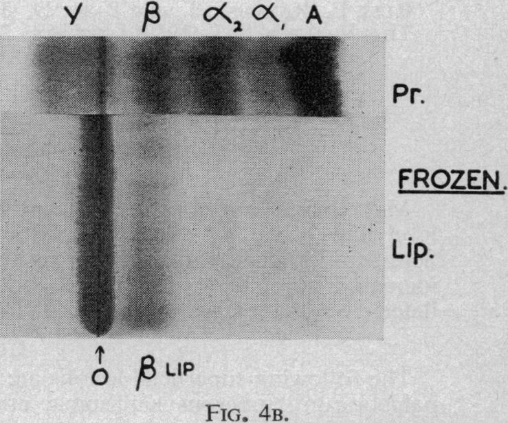 https://cdn.ncbi.nlm.nih.gov/pmc/blobs/2366/1889264/9fa7f473e456/procrsmed00376-0139-d.jpg