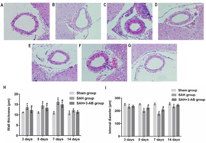 https://cdn.ncbi.nlm.nih.gov/pmc/blobs/236a/6327579/964c73eabe16/etm-17-02-1290-g03.jpg