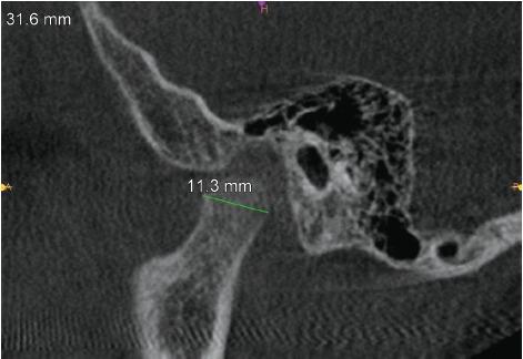 https://cdn.ncbi.nlm.nih.gov/pmc/blobs/2374/10978514/9520de91dec2/ijcpd-17-7-g006.jpg