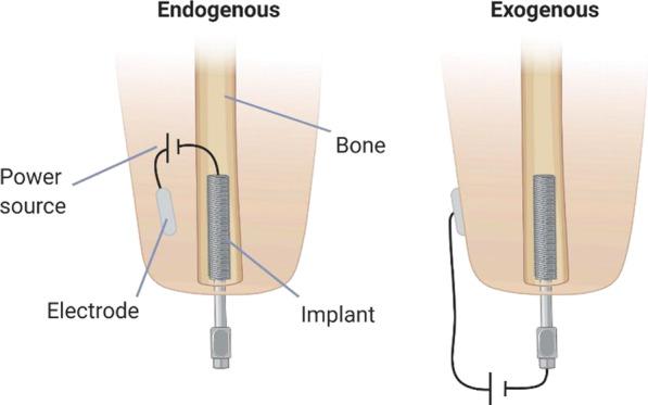 https://cdn.ncbi.nlm.nih.gov/pmc/blobs/2375/8939223/c472078f83ba/12984_2022_1005_Fig1_HTML.jpg