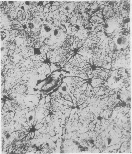 https://cdn.ncbi.nlm.nih.gov/pmc/blobs/2379/1023967/333f4abb6df3/jclinpath00037-0030-d.jpg