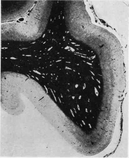 https://cdn.ncbi.nlm.nih.gov/pmc/blobs/2379/1023967/cc09bcc4bede/jclinpath00037-0031-a.jpg