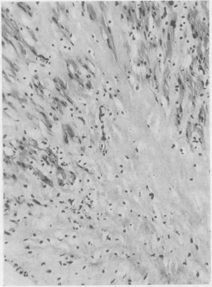 https://cdn.ncbi.nlm.nih.gov/pmc/blobs/2379/1023967/e6ac5ef7af76/jclinpath00037-0028-b.jpg