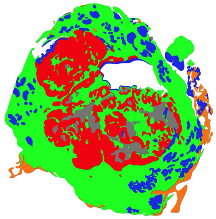 https://cdn.ncbi.nlm.nih.gov/pmc/blobs/237c/9332710/215ced87329e/diagnostics-12-01778-g011.jpg