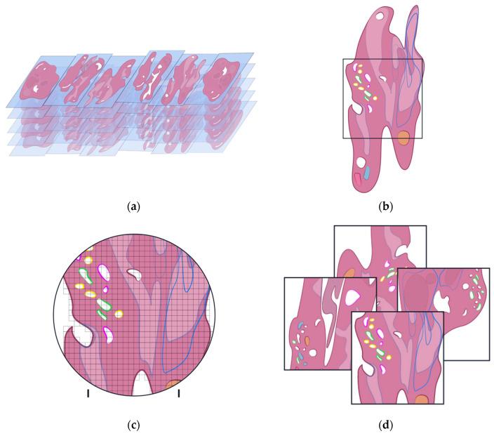 https://cdn.ncbi.nlm.nih.gov/pmc/blobs/237c/9332710/c8c6acbe0d71/diagnostics-12-01778-g006.jpg