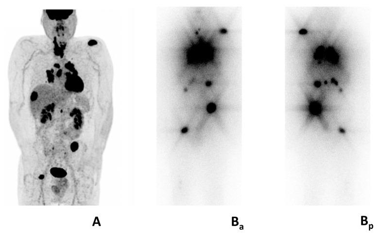 https://cdn.ncbi.nlm.nih.gov/pmc/blobs/237d/11642198/598243896900/jcm-13-07021-g002.jpg