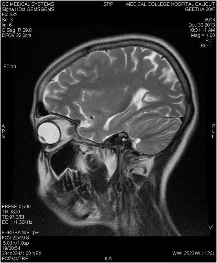 https://cdn.ncbi.nlm.nih.gov/pmc/blobs/237e/6656685/21513c6ec4fd/gr3.jpg