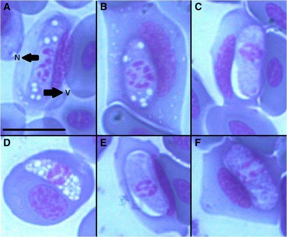 https://cdn.ncbi.nlm.nih.gov/pmc/blobs/237f/4298996/5cc4e30aa465/13071_2014_555_Fig2_HTML.jpg