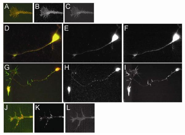 https://cdn.ncbi.nlm.nih.gov/pmc/blobs/2383/2987844/2c4af4455455/1749-8104-5-30-3.jpg