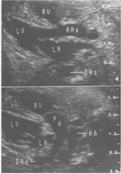 https://cdn.ncbi.nlm.nih.gov/pmc/blobs/2389/1011341/3e1350d85975/westjmed00073-0058-b.jpg