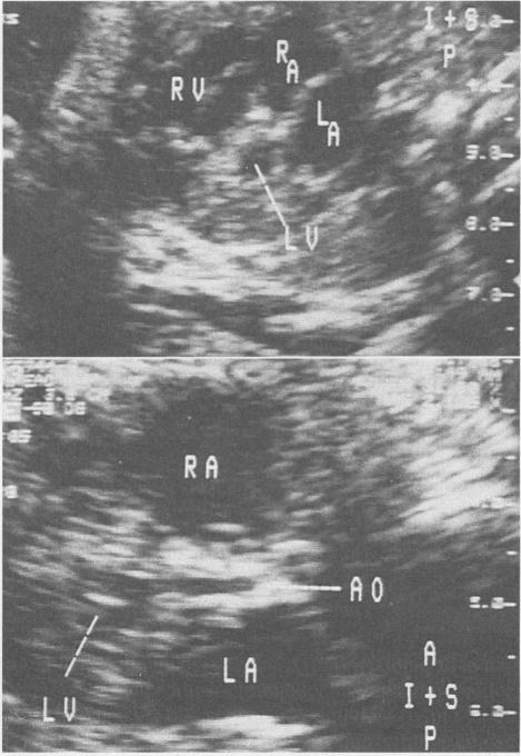 https://cdn.ncbi.nlm.nih.gov/pmc/blobs/2389/1011341/705eddc42c58/westjmed00073-0062-b.jpg